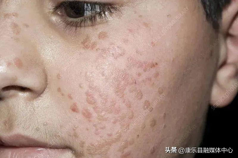 第461页